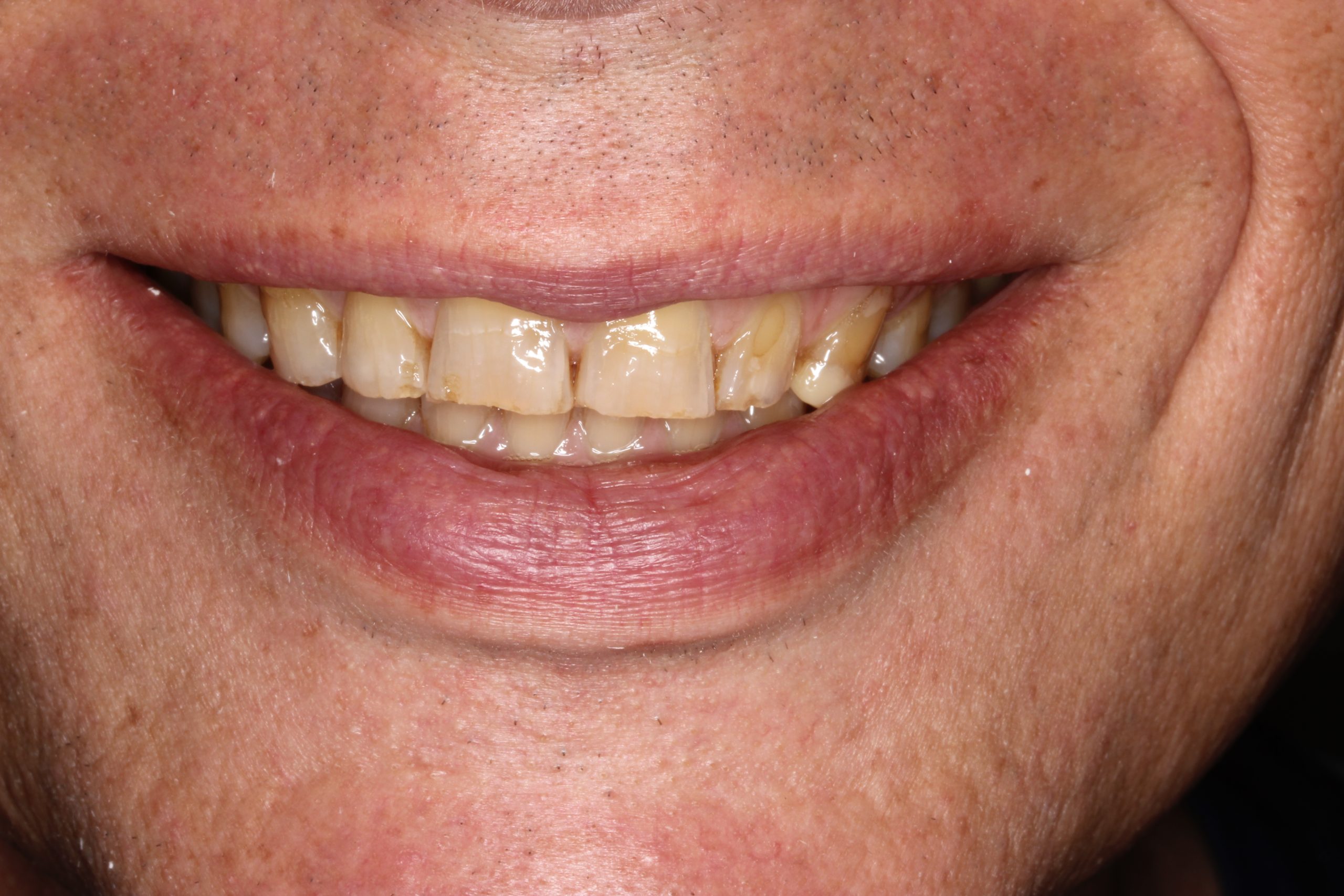 teeth
